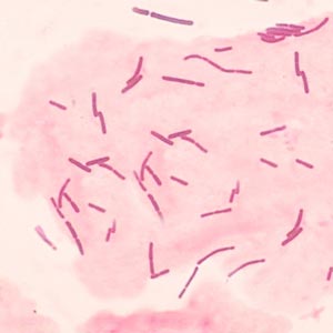 ラクトバチルス菌