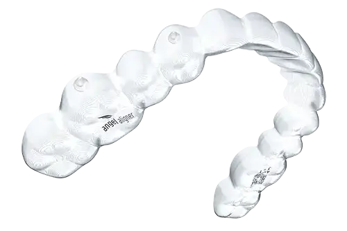 エンジェルアライナーの矯正措置