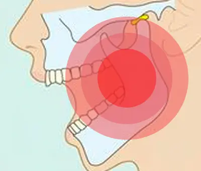 咬筋から発生する咬合力のイメージ