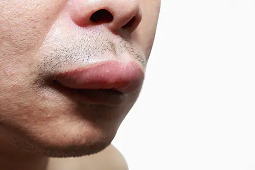 口唇の腫れぼったい男性