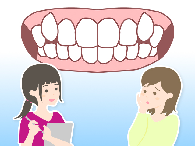 八重歯のイメージ